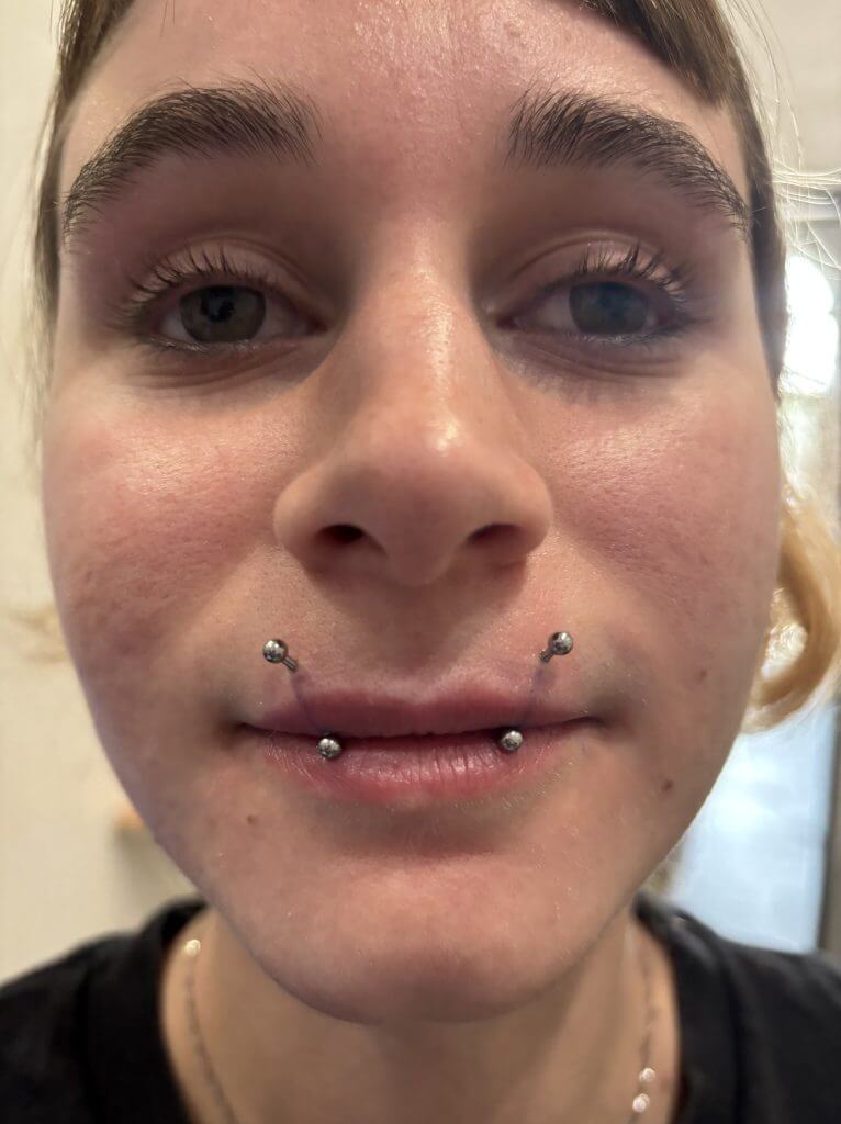 Angel Bites body piercings ni Ariana King sa Iron Palm Tattoos sa downtown Atlanta. Ang Angel Bites, minsan tinatawag na Angel Fangs, ay $100 sa Iron Palm Jewelry ay kasama sa serbisyo.
